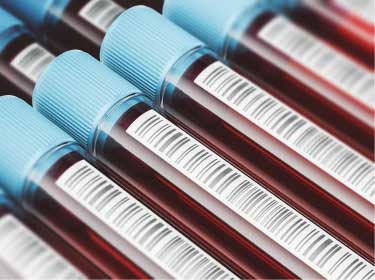 PHCbi Blood Sample Storage
