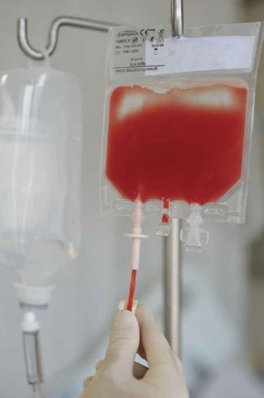 超深冷却による赤血球保存期間の増大