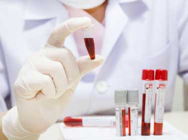 バイオマーカーによる保存血液試料の保全性の評価