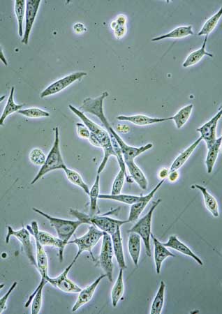 バイオバンクでの保存期間は摂取したサンプルの年齢と同じぐらい重要か